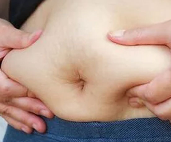 Belly Fat