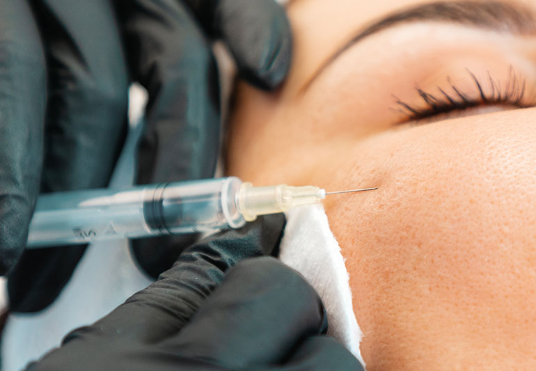Dermal Fillers